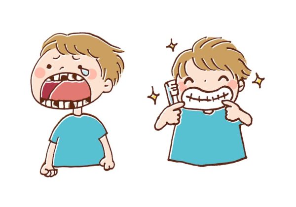 虫歯と歯磨き
